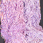 Prism Wicket Ikat Yarn - Lavender Prism Wicket Ikat Yarn - Lavender